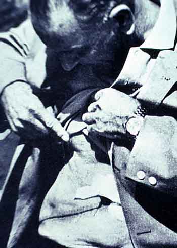 LBJ points to scar